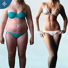 Gastric Balloon Before and After