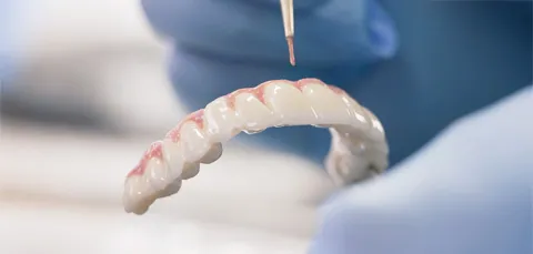 Close-up of technician detailing All-on-6 or All-on-8 dental implant bridge