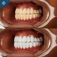 Dazzling Dental Makeover
