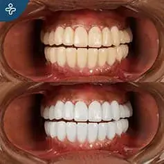 Dazzling Dental Makeover