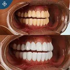 Dazzling Dental Makeover