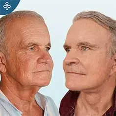 Rhytidectomy Before and After