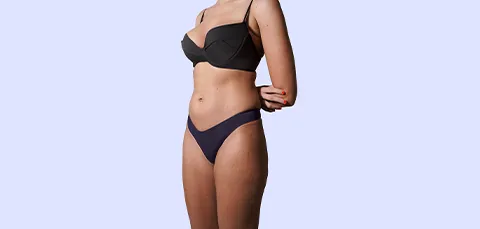 Woman showing toned waist and sculpted silhouette in black lingerie after body contouring surgery in Turkey, side angle.