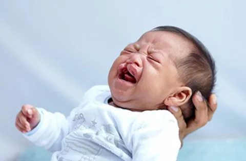 Cleft Lip and Cleft Palate