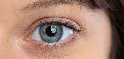 A close-up of a blue human eye, illustrating the cornea and iris