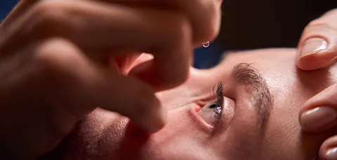 Person applying eye drops to relieve dryness caused by contact lens use, showing treatment for dry eye syndrome.