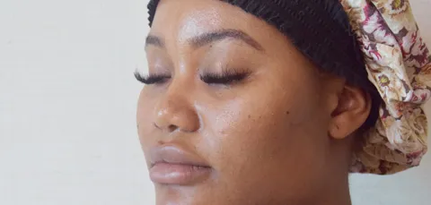 Side view of woman after ethnic rhinoplasty in Turkey, showing refined nasal shape while preserving natural ethnic features.