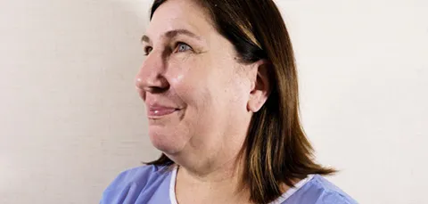 Side view of woman after face and neck rejuvenation in Turkey, showing lifted jawline and smoother facial contours.