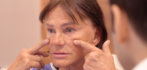 Mature patient discussing facelift technique with surgeon in Turkey, pointing to lower face and cheeks