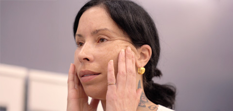 Woman gently touching her cheeks while evaluating facial contour after liposuction