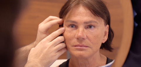 Patient in mirror during facial rejuvenation consultation in Turkey, surgeon lifting skin to show results