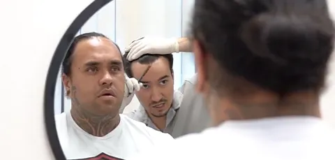 Patient and doctor reviewing hairline design in mirror before FUE hair transplant