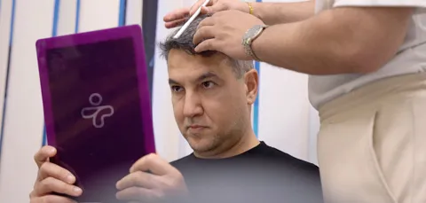 Male hair transplant patient checking hairline design in mirror during consultation