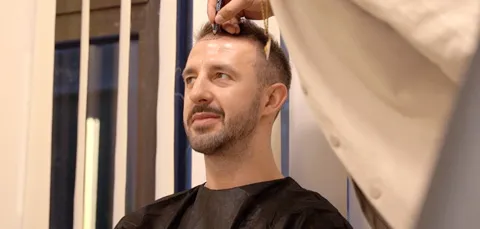 Male patient receiving hairline markings before hair transplant procedure