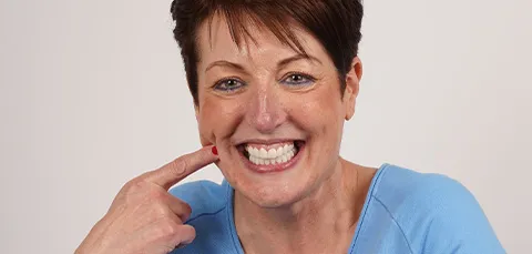 Happy woman smiling brightly and pointing to her beautiful full mouth dental implants