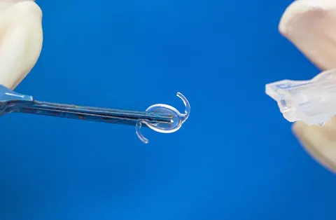 IOLs (Implants de Lentilles Intraoculaires)