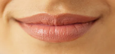 lip-filler-augmentation-turkey