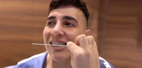 Male patient with braces undergoing pre-op dental check before jaw surgery