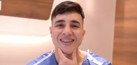 Male patient smiling after mandibular osteotomy in Turkey, showing improved jaw alignment and braces