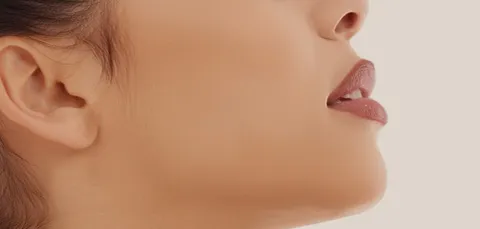 Close-up side view of a woman’s chin and jawline after mentoplasty surgery in Turkey