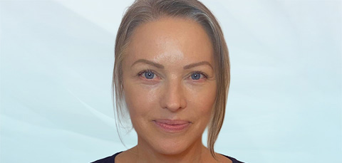 Middle-aged woman with smooth skin, representing successful results when considering the facelift cost in the UK