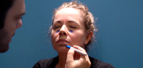 Plastic surgeon Ahmet Hamdi Sakarya marking face of Care in Turkey's Mini Facelift Patient