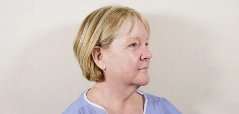 Side view of mature woman with loose neck skin and sagging jawline before neck lift surgery in Turkey, wearing medical gown.