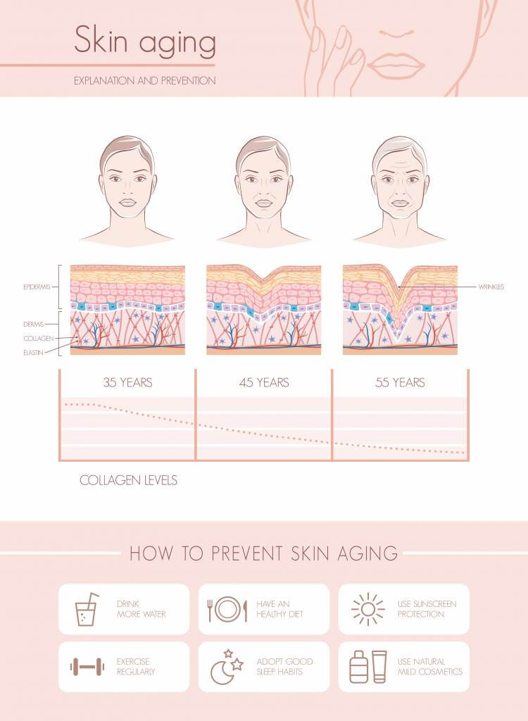 A diagram showing the common signs of facial aging like wrinkles, volume loss, and sagging.