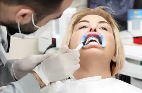 Blanqueamiento dental