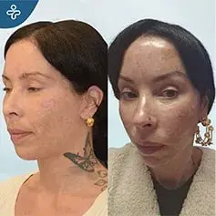 8-Month Temporal Lift Result