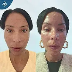 8-Month Temporal Lift Result