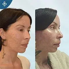 8-Month Temporal Lift Result