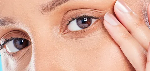 A close-up of a woman’s eyes with her finger gently touching the skin below her lower eyelid to illustrate under-eye bags.